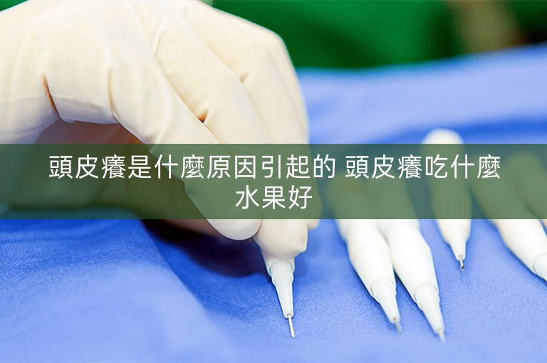 頭皮癢是什麼原因引起的 頭皮癢吃什麼水果好