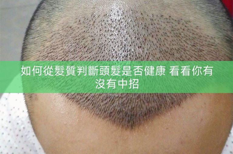 如何從髮質判斷頭髮是否健康 看看你有沒有中招