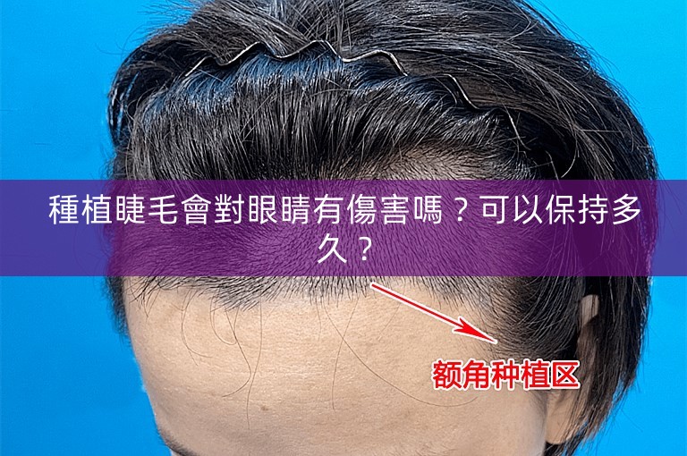 種植睫毛會對眼睛有傷害嗎？可以保持多久？