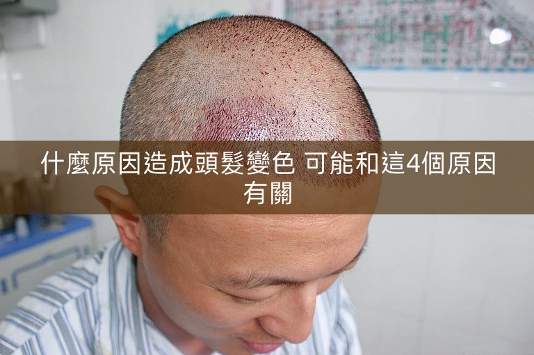 什麼原因造成頭髮變色 可能和這4個原因有關 什麼原因造成頭髮變色 可能和這4個原因有關