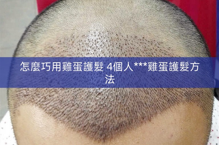 怎麼巧用雞蛋護髮 4個人***雞蛋護髮方法