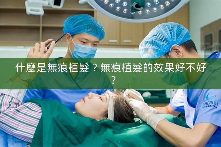 什麼是無痕植髮？無痕植髮的效果好不好？