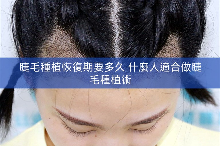 睫毛種植恢復期要多久 什麼人適合做睫毛種植術
