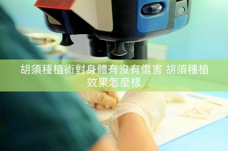 胡須種植術對身體有沒有傷害 胡須種植效果怎麼樣