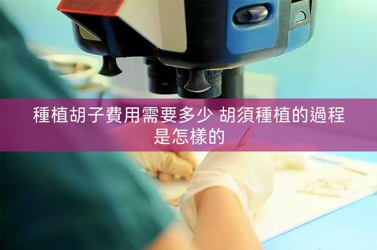 種植胡子費用需要多少 胡須種植的過程是怎樣的
