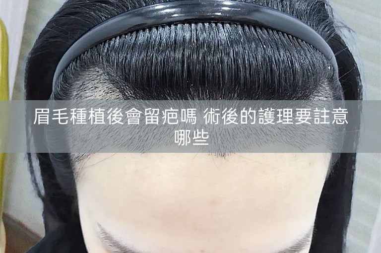 眉毛種植後會留疤嗎 術後的護理要註意哪些