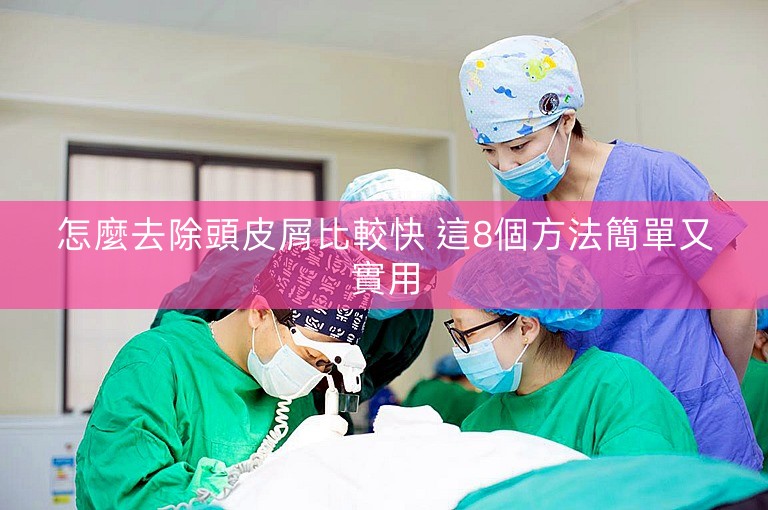 怎麼去除頭皮屑比較快 這8個方法簡單又實用