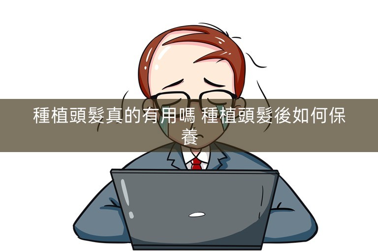 種植頭髮真的有用嗎 種植頭髮後如何保養