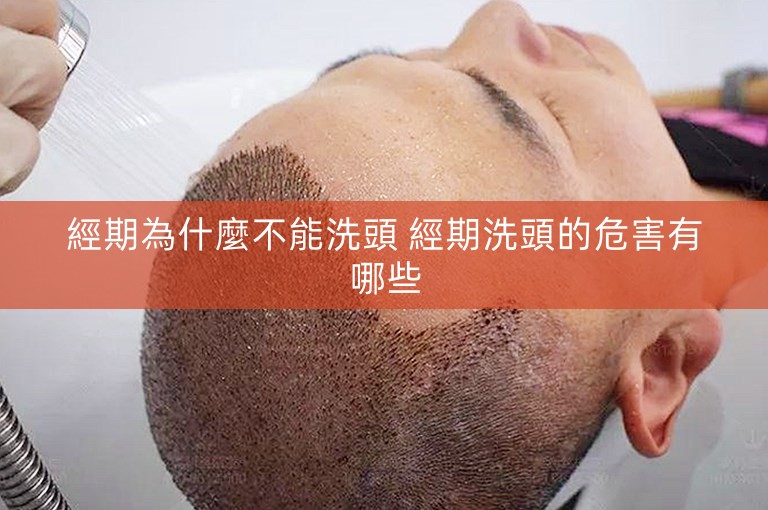 經期為什麼不能洗頭 經期洗頭的危害有哪些