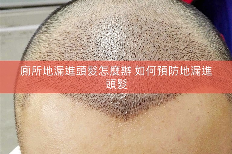 廁所地漏進頭髮怎麼辦 如何預防地漏進頭髮