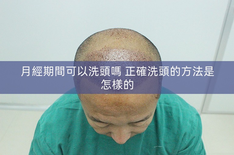 月經期間可以洗頭嗎 正確洗頭的方法是怎樣的