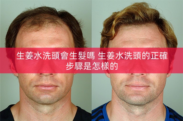 生姜水洗頭會生髮嗎 生姜水洗頭的正確步驟是怎樣的