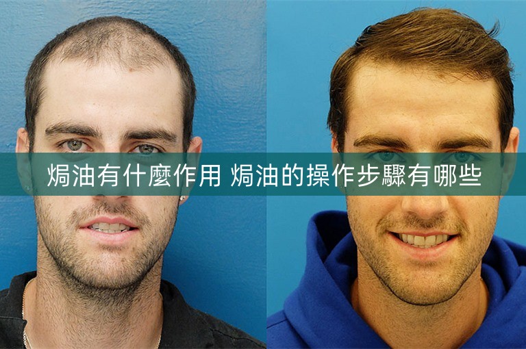 焗油有什麼作用 焗油的操作步驟有哪些