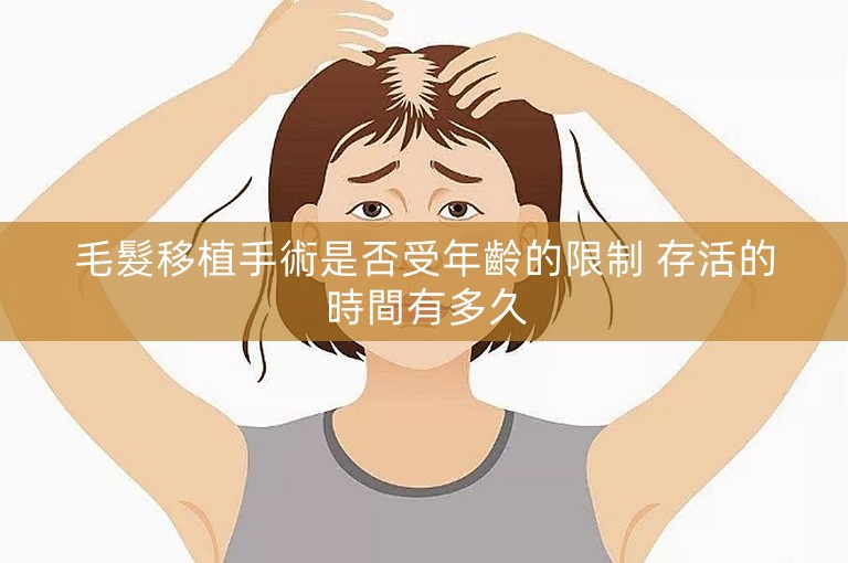 毛髮移植手術是否受年齡的限制 存活的時間有多久