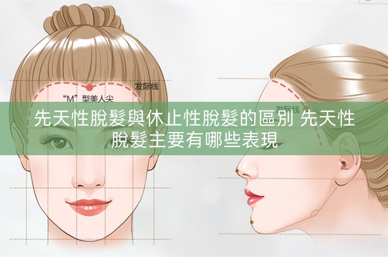 先天性脫髮與休止性脫髮的區別 先天性脫髮主要有哪些表現 先天性脫髮與休止性脫髮的區別 先天性脫髮主要有哪些表現