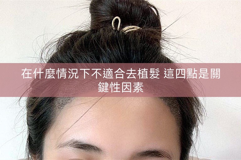 在什麼情況下不適合去植髮 這四點是關鍵性因素