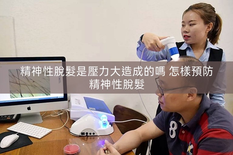 精神性脫髮是壓力大造成的嗎 怎樣預防精神性脫髮