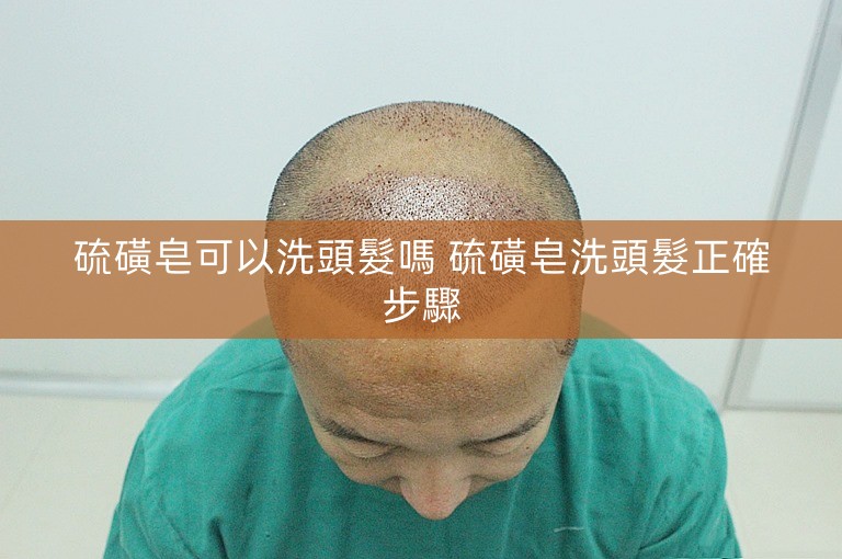 硫磺皂可以洗頭髮嗎 硫磺皂洗頭髮正確步驟 硫磺皂可以洗頭髮嗎 硫磺皂洗頭髮正確步驟