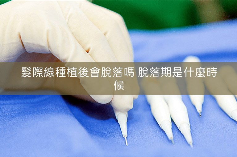 髮際線種植後會脫落嗎 脫落期是什麼時候