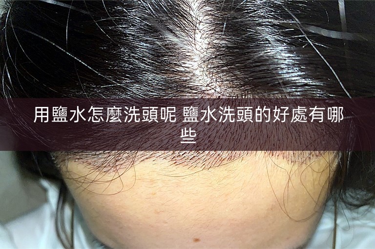 用鹽水怎麼洗頭呢 鹽水洗頭的好處有哪些