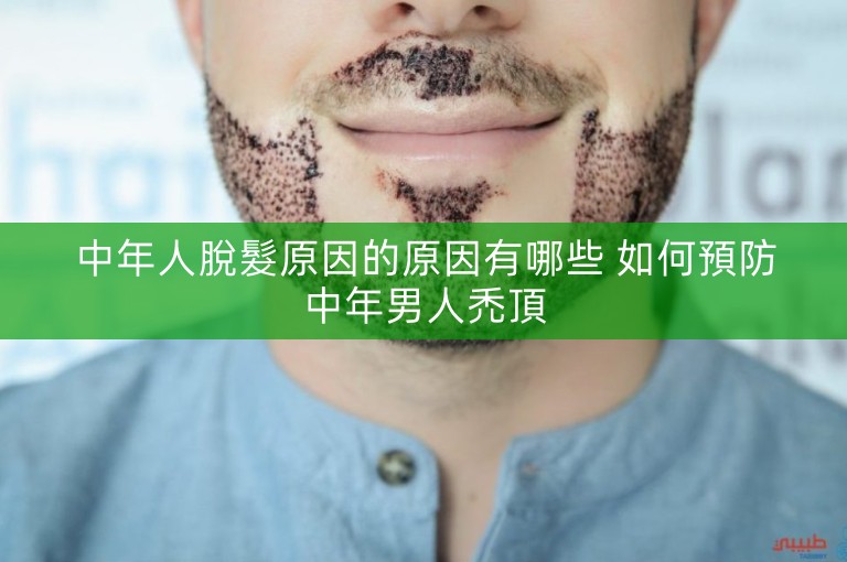 中年人脫髮原因的原因有哪些 如何預防中年男人禿頂