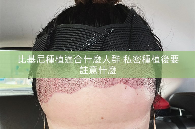 比基尼種植適合什麼人群 私密種植後要註意什麼