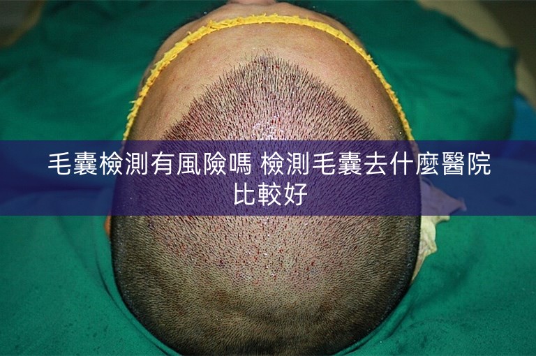 毛囊檢測有風險嗎 檢測毛囊去什麼醫院比較好
