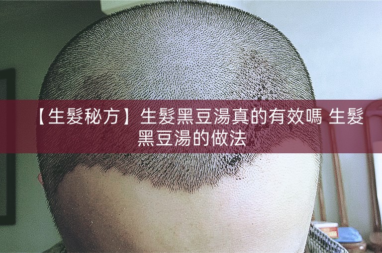 【生髮秘方】生髮黑豆湯真的有效嗎 生髮黑豆湯的做法 【生髮秘方】生髮黑豆湯真的有效嗎 生髮黑豆湯的做法