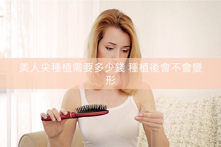美人尖種植需要多少錢 種植後會不會變形