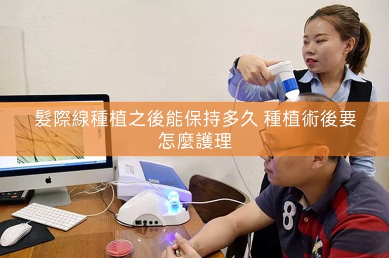 髮際線種植之後能保持多久 種植術後要怎麼護理