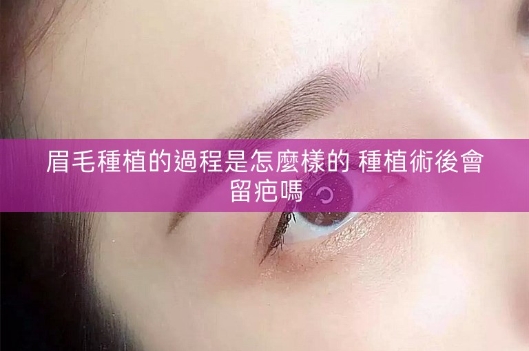 眉毛種植的過程是怎麼樣的 種植術後會留疤嗎