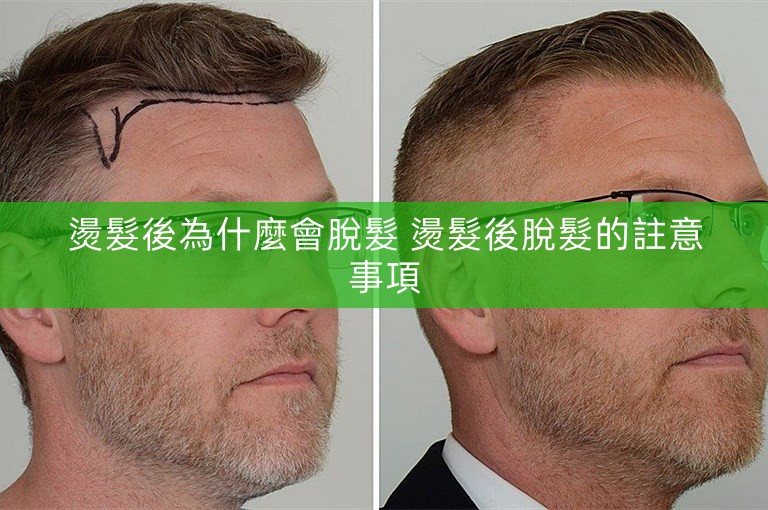 燙髮後為什麼會脫髮 燙髮後脫髮的註意事項 燙髮後為什麼會脫髮 燙髮後脫髮的註意事項