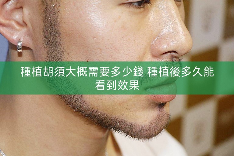 種植胡須大概需要多少錢 種植後多久能看到效果