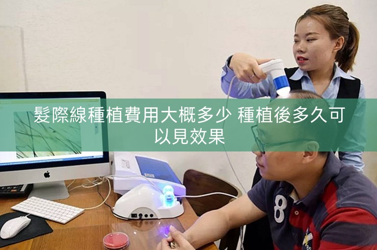 髮際線種植費用大概多少 種植後多久可以見效果