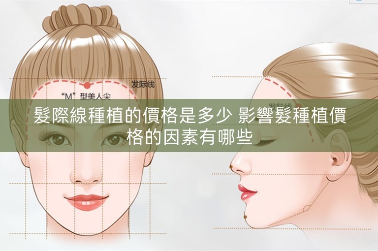髮際線種植的價格是多少 影響髮種植價格的因素有哪些