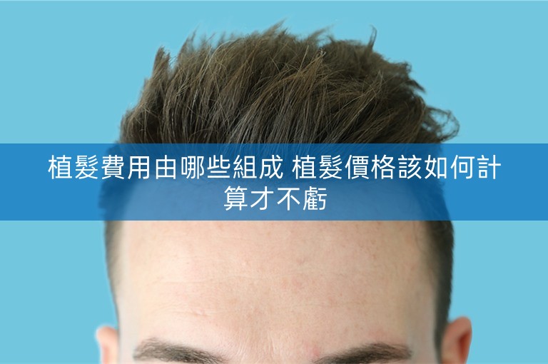 植髮費用由哪些組成 植髮價格該如何計算才不虧