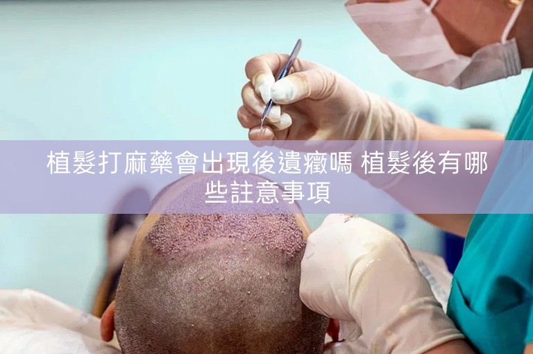 植髮打麻藥會出現後遺癥嗎 植髮後有哪些註意事項