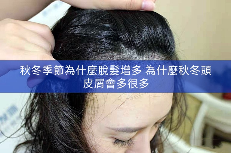 秋冬季節為什麼脫髮增多 為什麼秋冬頭皮屑會多很多