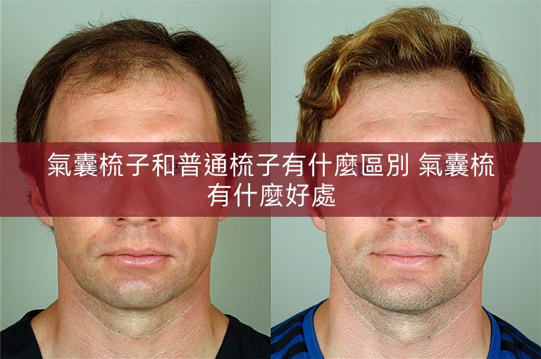 氣囊梳子和普通梳子有什麼區別 氣囊梳有什麼好處