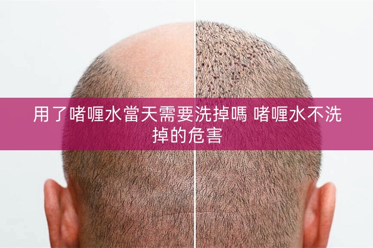 用了啫喱水當天需要洗掉嗎 啫喱水不洗掉的危害
