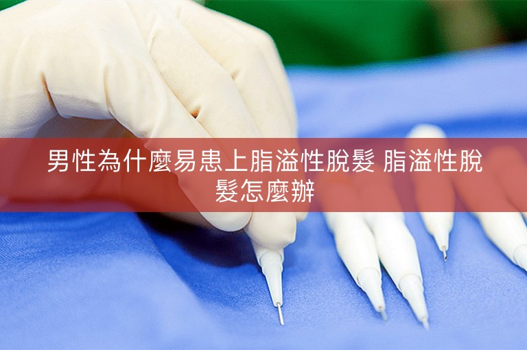 男性為什麼易患上脂溢性脫髮 脂溢性脫髮怎麼辦