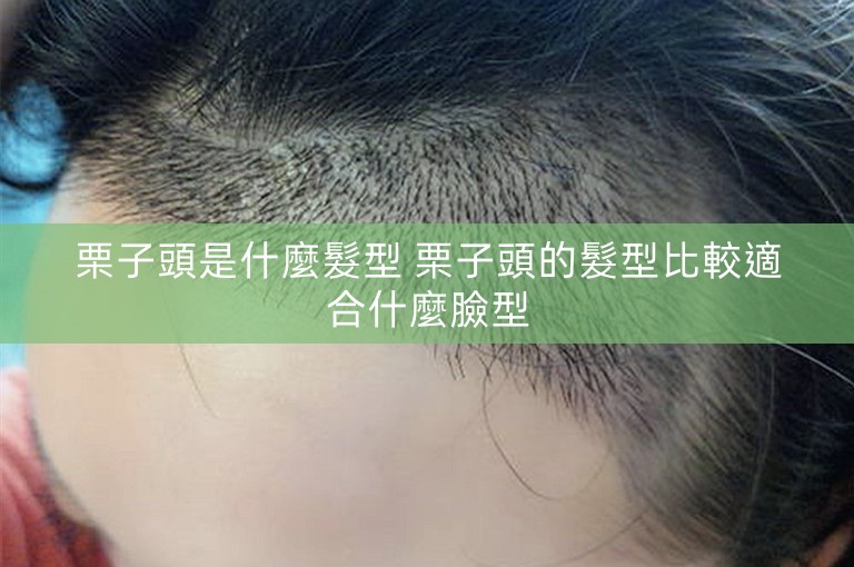 栗子頭是什麼髮型 栗子頭的髮型比較適合什麼臉型 栗子頭是什麼髮型 栗子頭的髮型比較適合什麼臉型