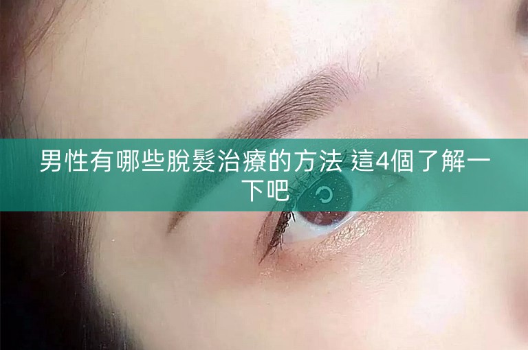 男性有哪些脫髮治療的方法 這4個了解一下吧