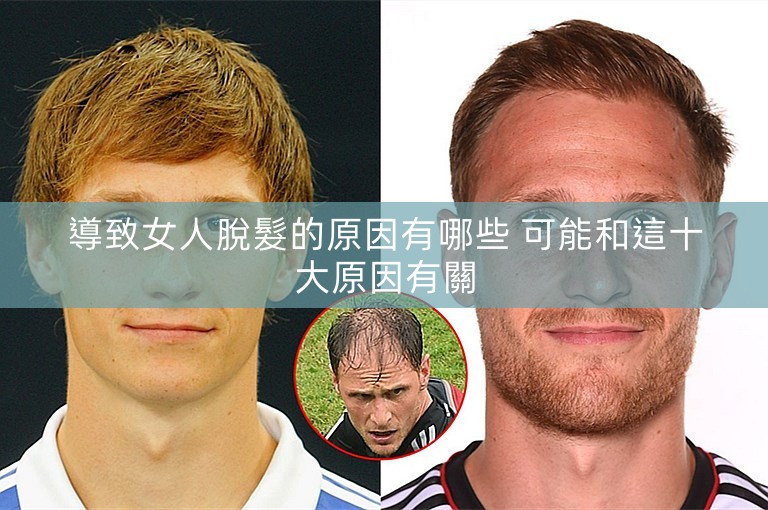 導致女人脫髮的原因有哪些 可能和這十大原因有關 導致女人脫髮的原因有哪些 可能和這十大原因有關