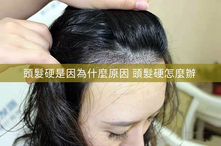 頭髮硬是因為什麼原因 頭髮硬怎麼辦 頭髮硬是因為什麼原因 頭髮硬怎麼辦