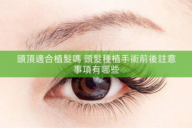 頭頂適合植髮嗎 頭髮種植手術前後註意事項有哪些