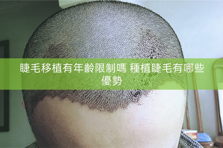 睫毛移植有年齡限制嗎 種植睫毛有哪些優勢