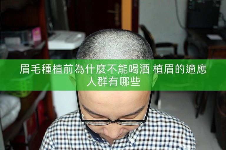 眉毛種植前為什麼不能喝酒 植眉的適應人群有哪些