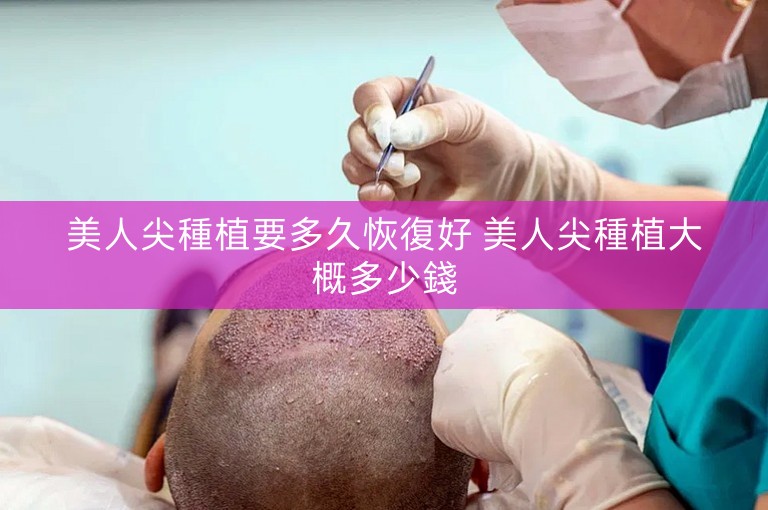 美人尖種植要多久恢復好 美人尖種植大概多少錢