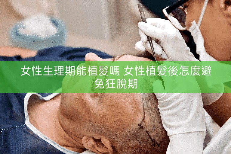 女性生理期能植髮嗎 女性植髮後怎麼避免狂脫期 女性生理期能植髮嗎 女性植髮後怎麼避免狂脫期